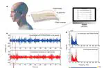 Stable and low-resistance polydopamine methacrylamide-polyacrylamide hydrogel for brain-computer interface